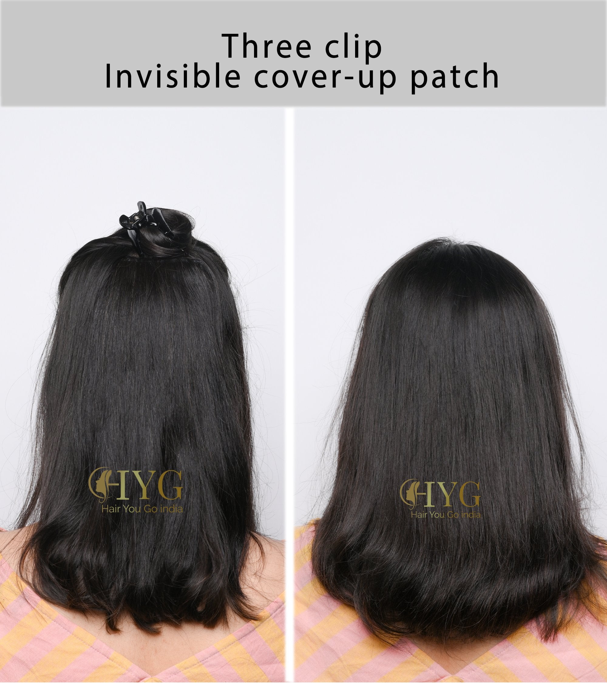 Invisible Cover-Up Patches (Three Clip)