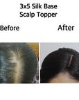 Scalp Topper (3x5)