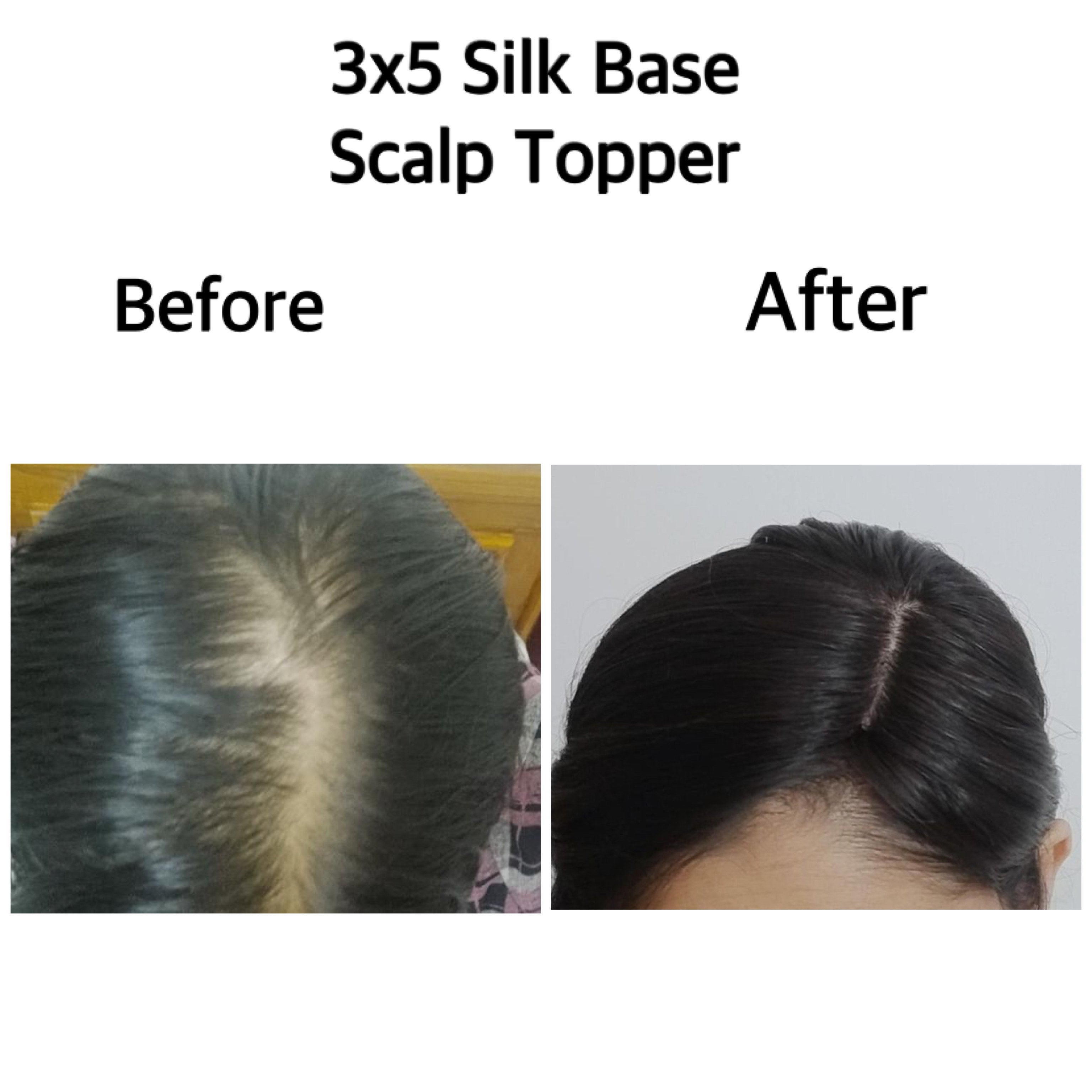 Scalp Topper (3x5)